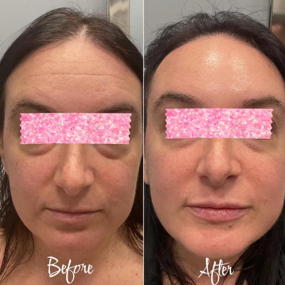 Before and After Treatment