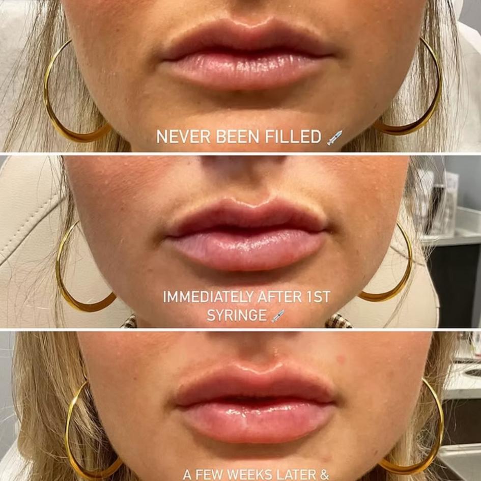 Before and After Treatment