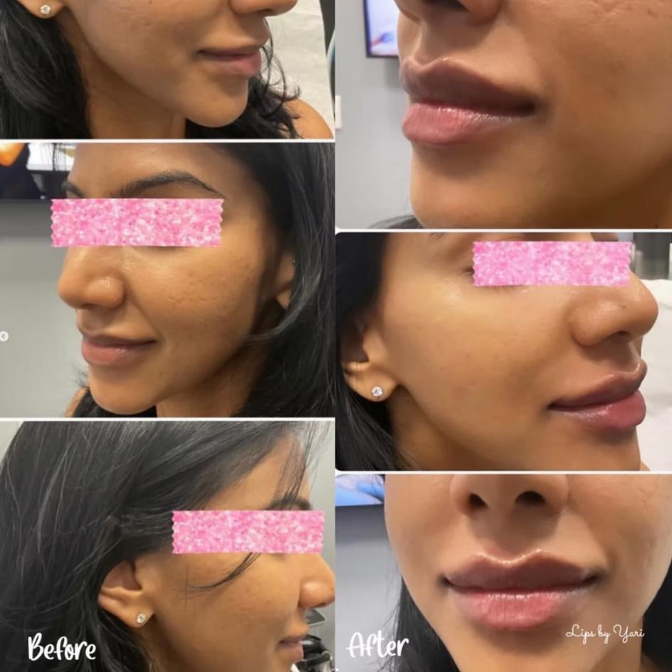 Before and After Treatment