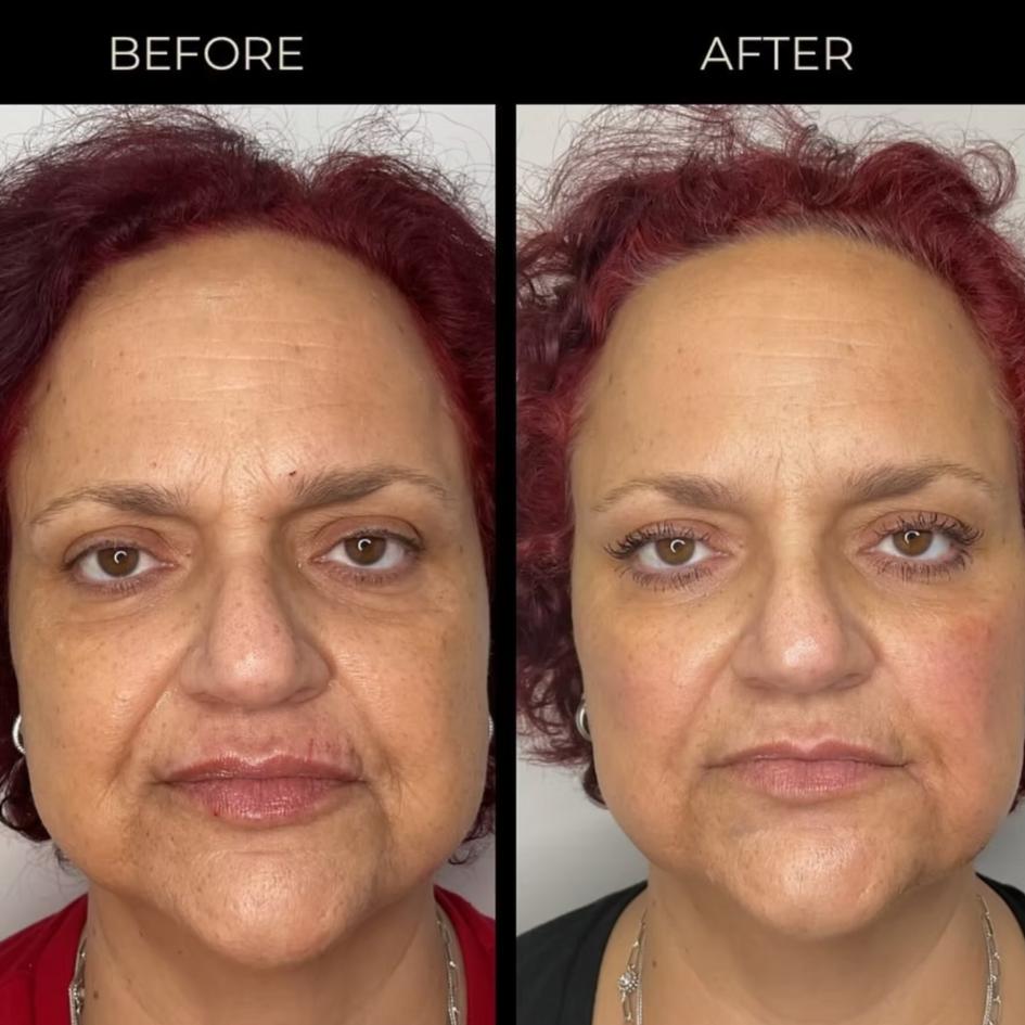 Before and After Treatment