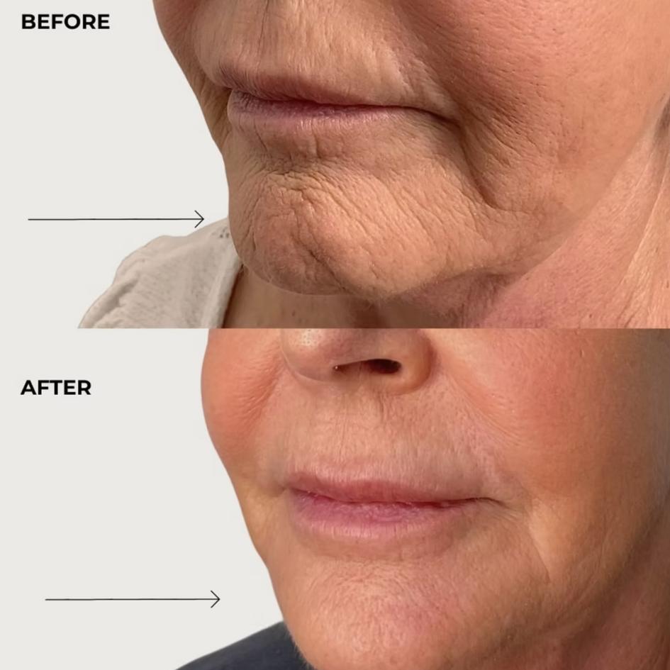 Before and After Treatment