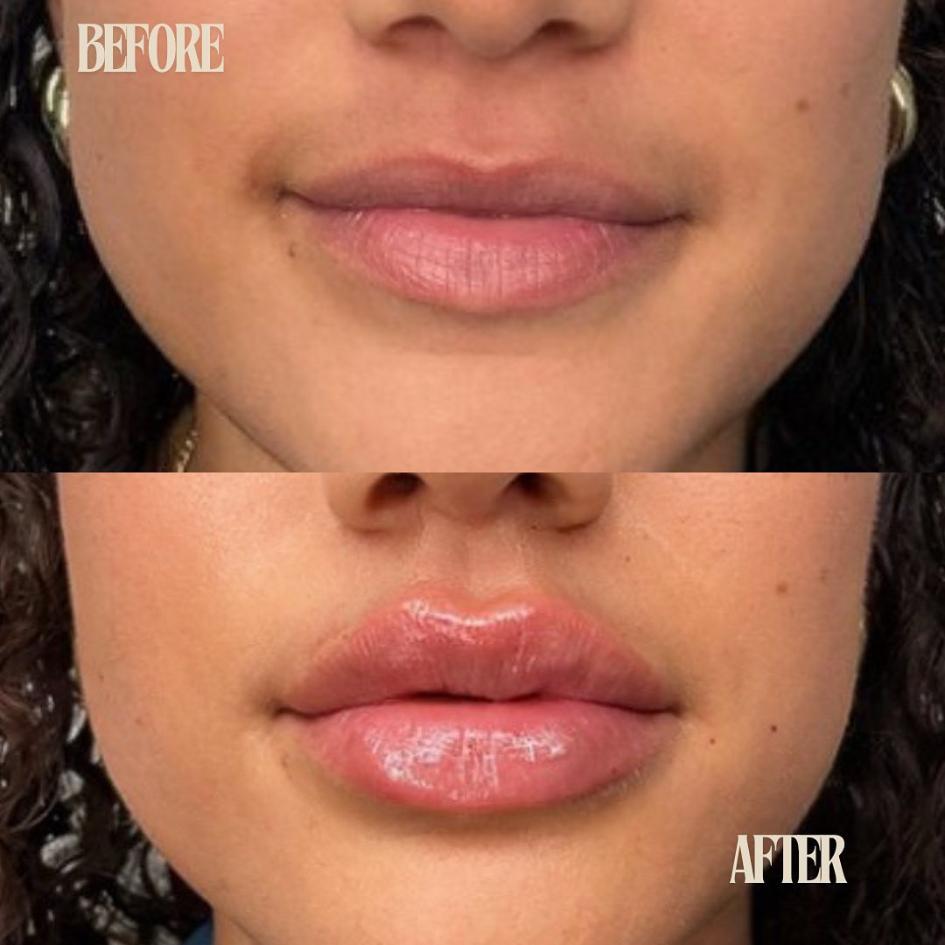 Before and After Treatment