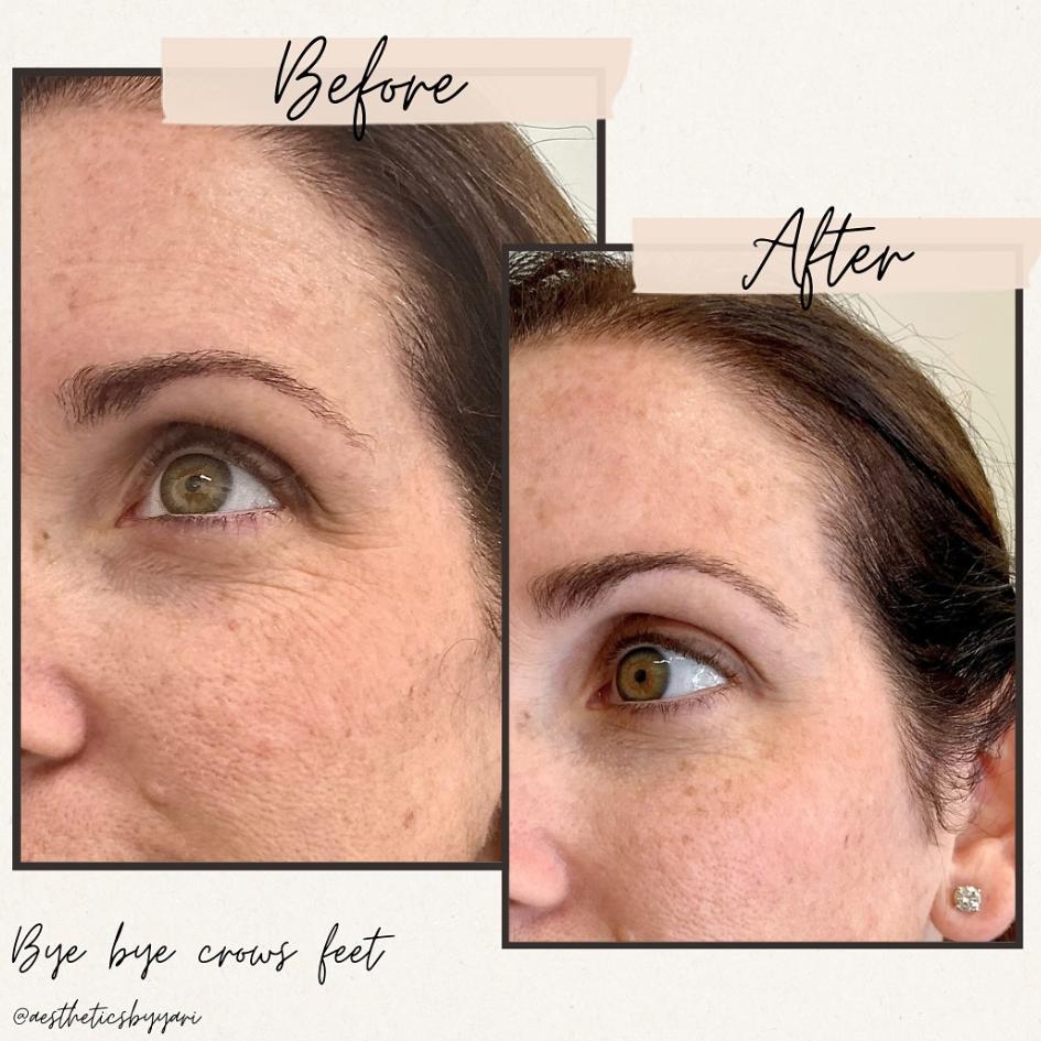 Before and After Treatment