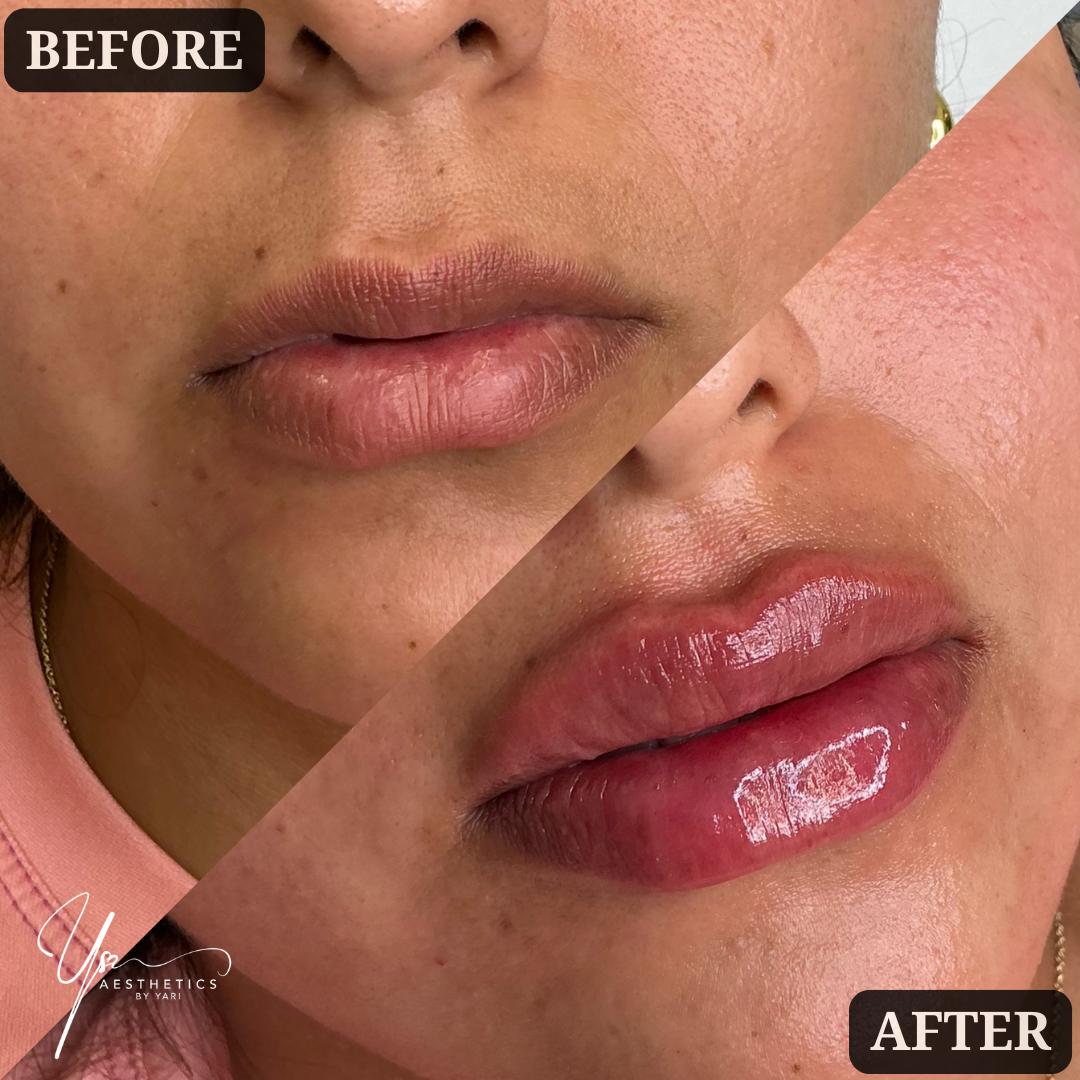 Guía Completa: Tratamientos Estéticos en Boca Raton