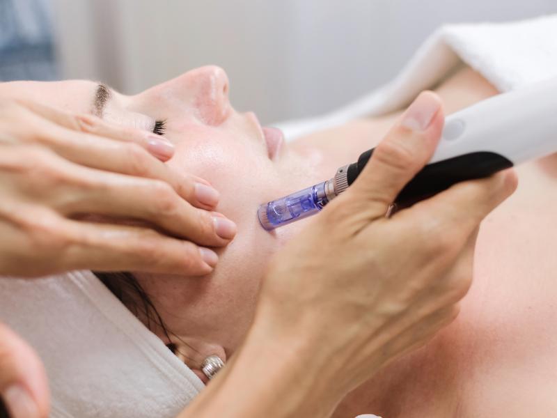 Biostimulator treatment at Aesthetics by Yari