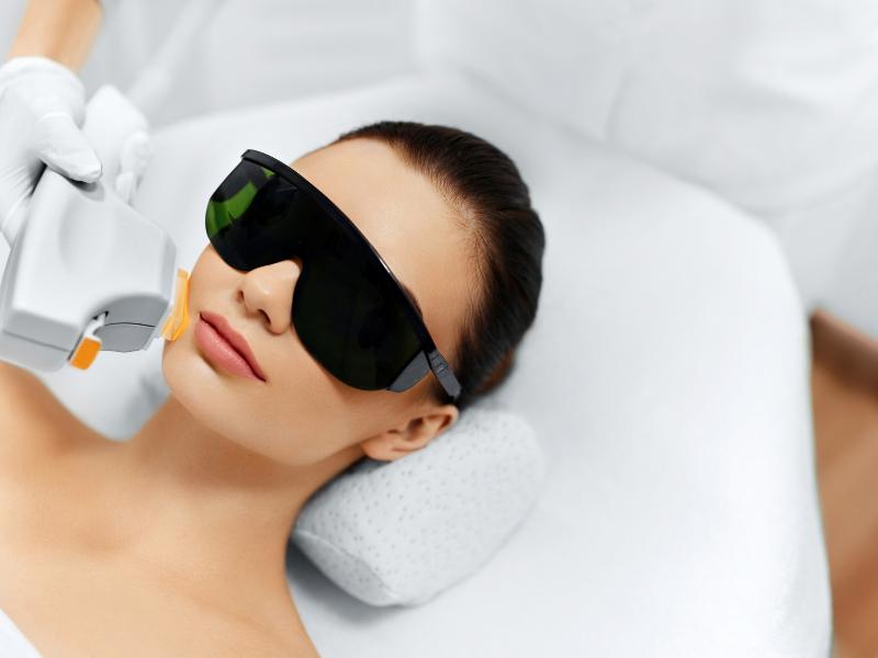 IPL skin treatment at Aesthetics by Yari